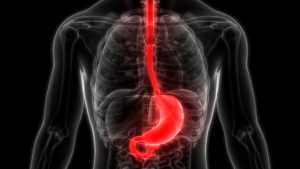 Heartburn or acid reflux occurs when acids move back up into your esophagus from your stomach.