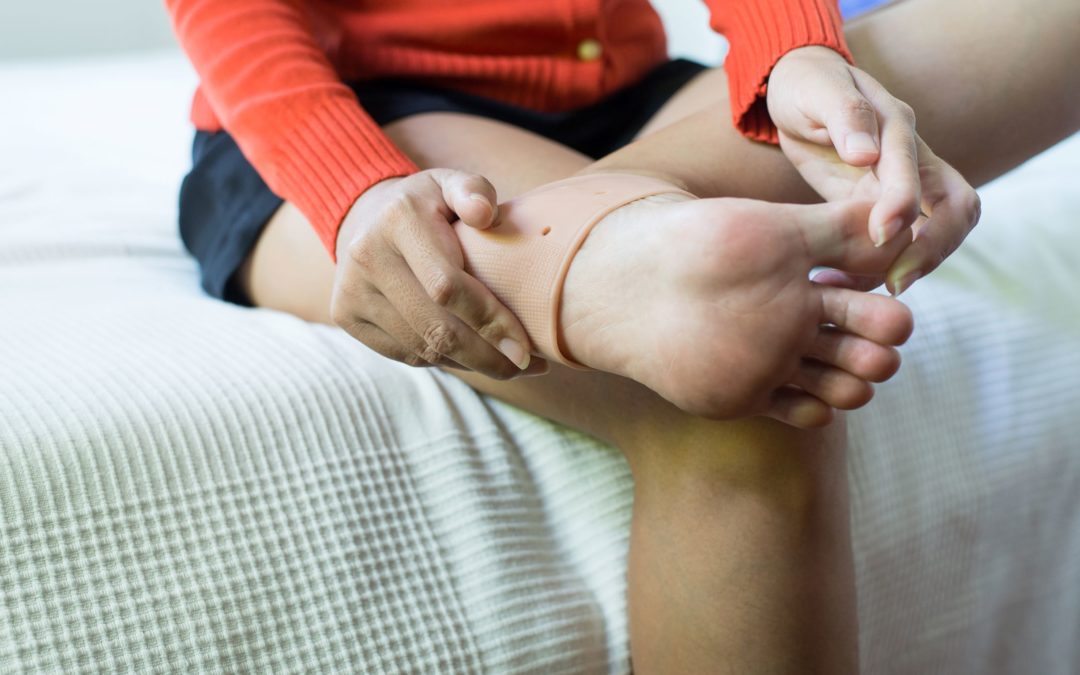 A woman uses support silicone on her heel to treat plantar fasciitis.